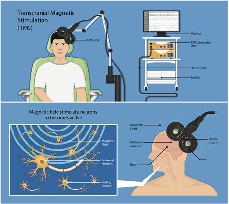 Deep Transcranial Magnetic Stimulation Effects on the .
